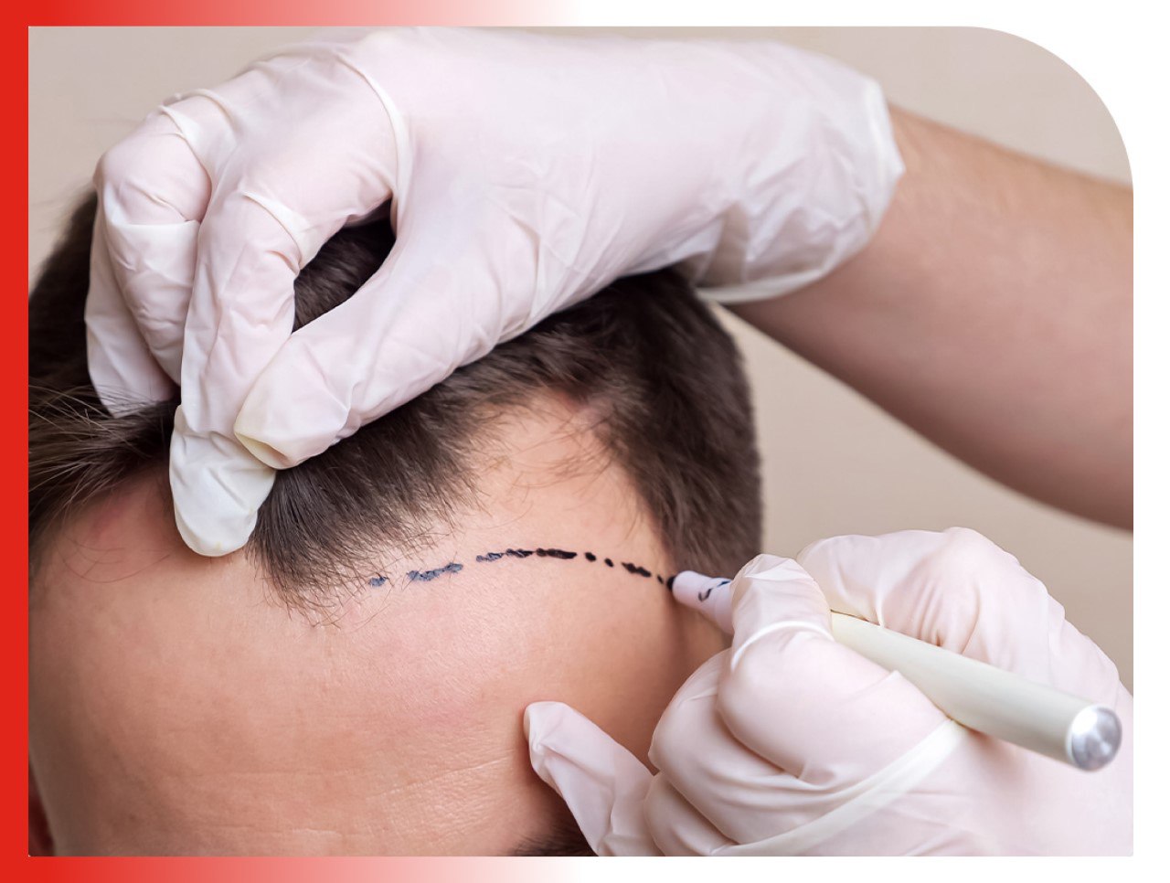 Academic Hair Clinic