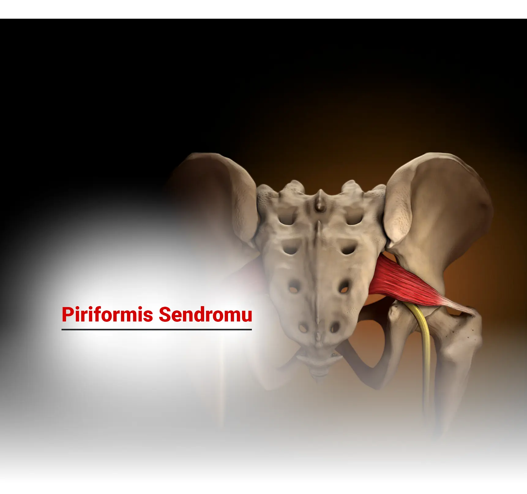 Piriformis Sendromu Nedir? Belirtileri ve Tedavisi