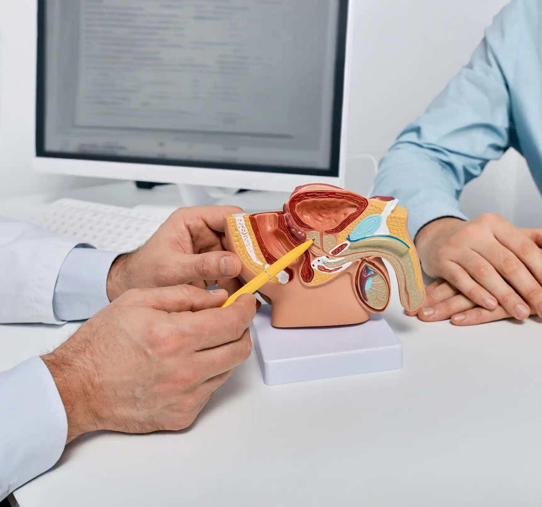 What Is Prostate Fusion Biopsy? How Is It Performed?