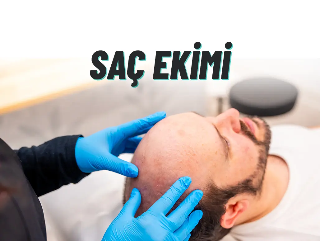 department-card-1