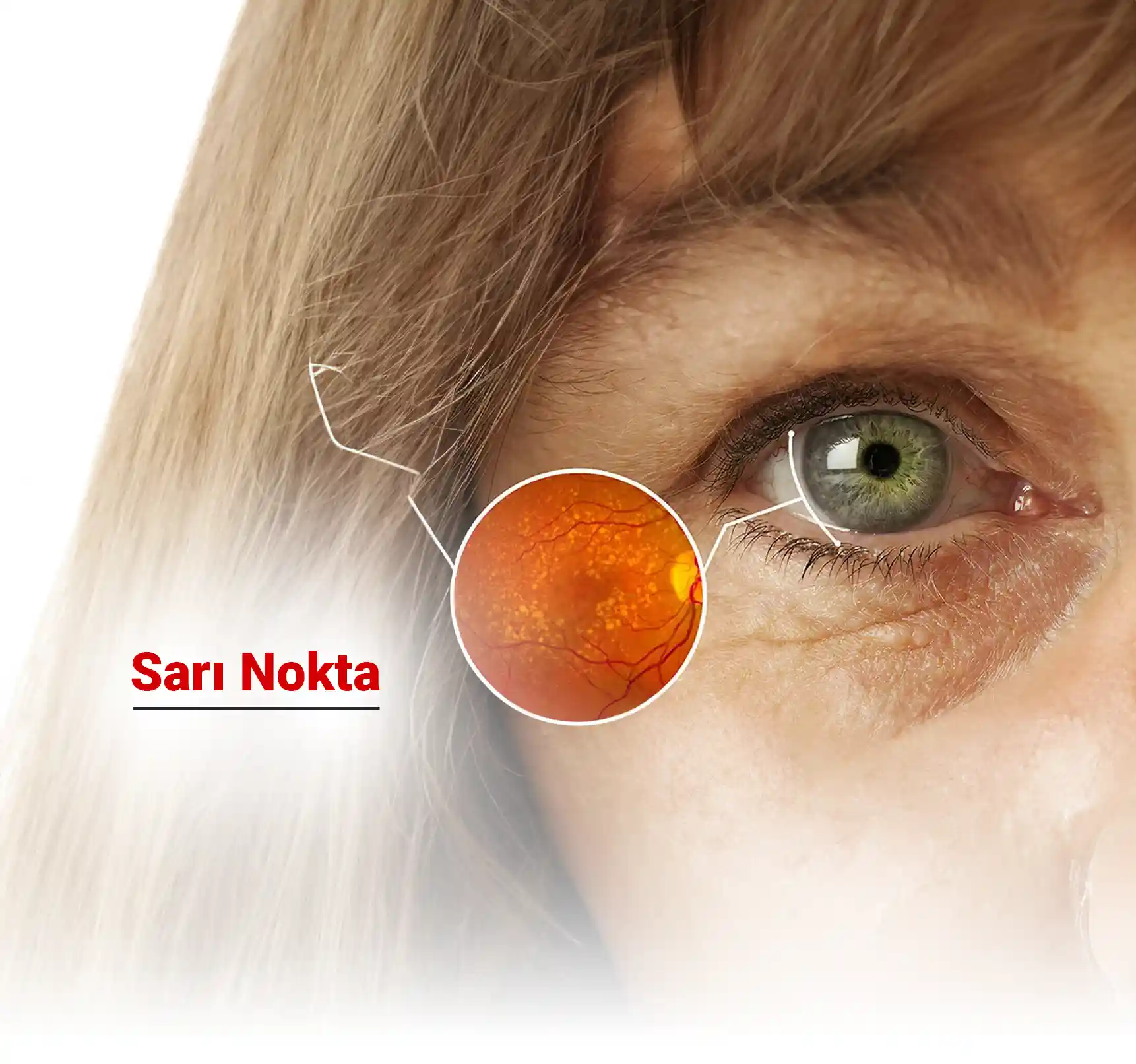 Sarı Nokta Nedir?