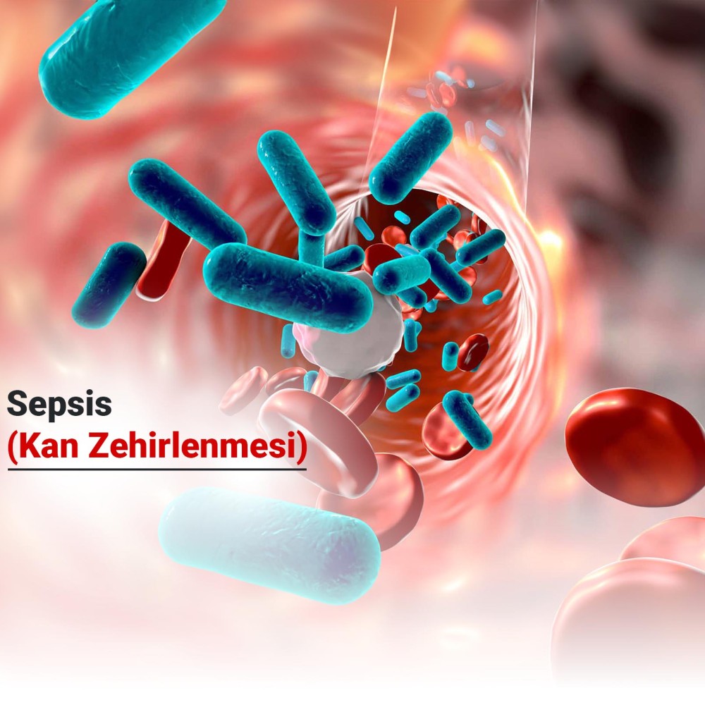 Sepsis (Kan Zehirlenmesi) Nedir?