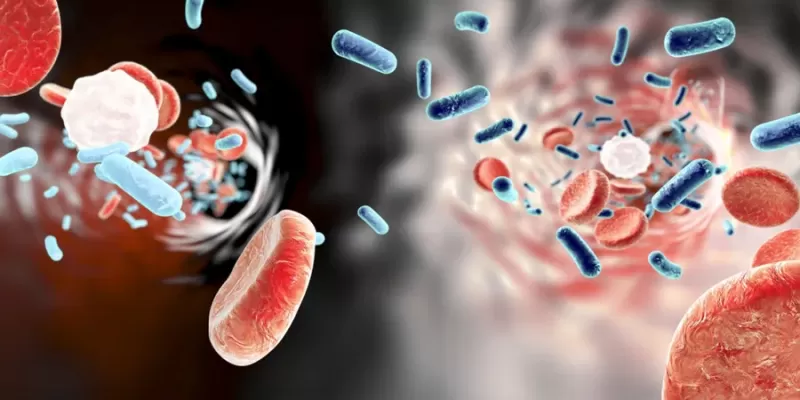 What Is Sepsis (Blood Poisoning)?