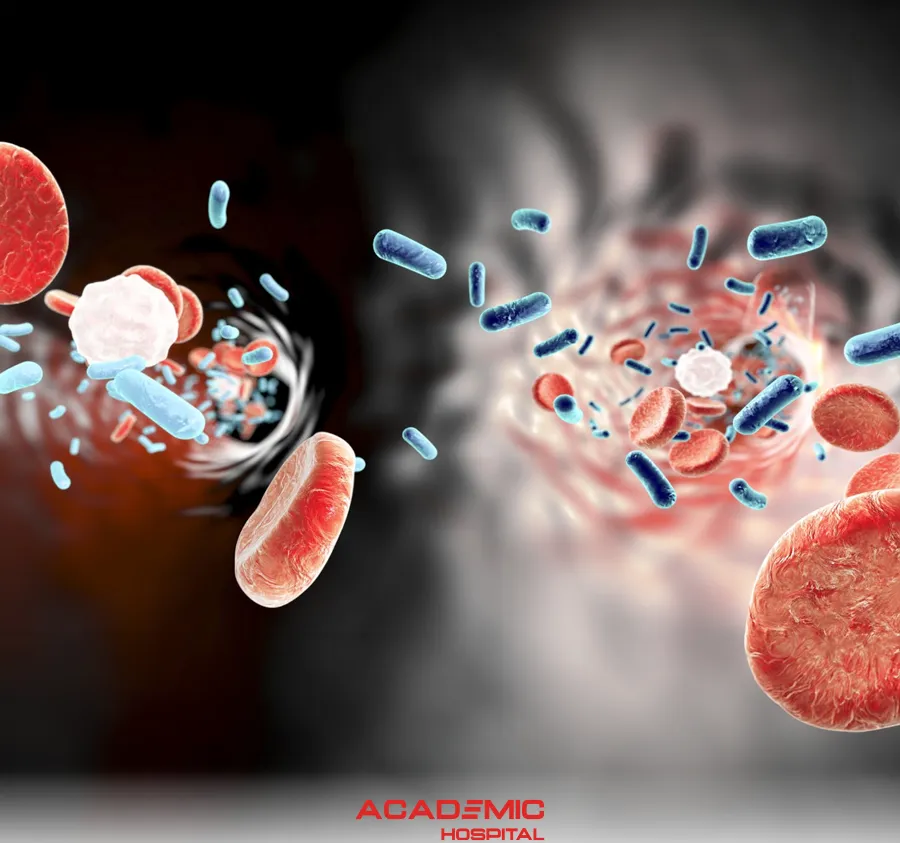 What Is Sepsis (Blood Poisoning)?