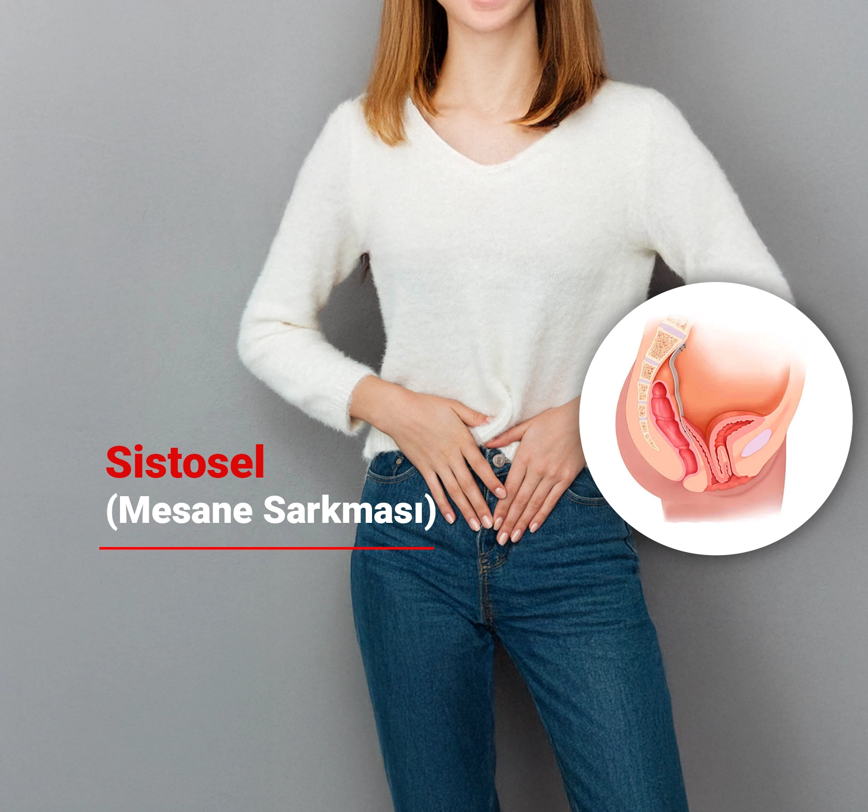 Pelvik Taban Sorunlarından Biri: Sistosel (Mesane Sarkması)