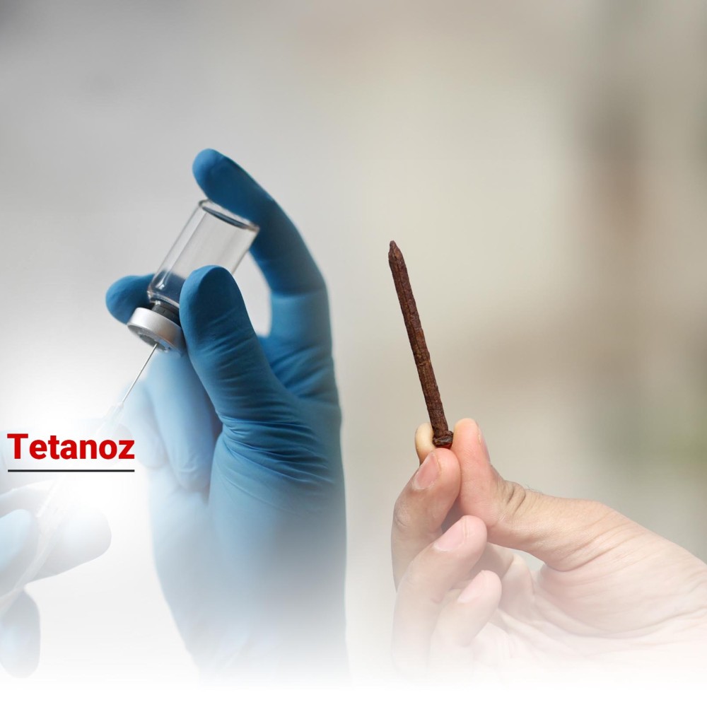 Tetanoz Nedir? Belirtileri, Tedavisi ve Korunma Yöntemleri