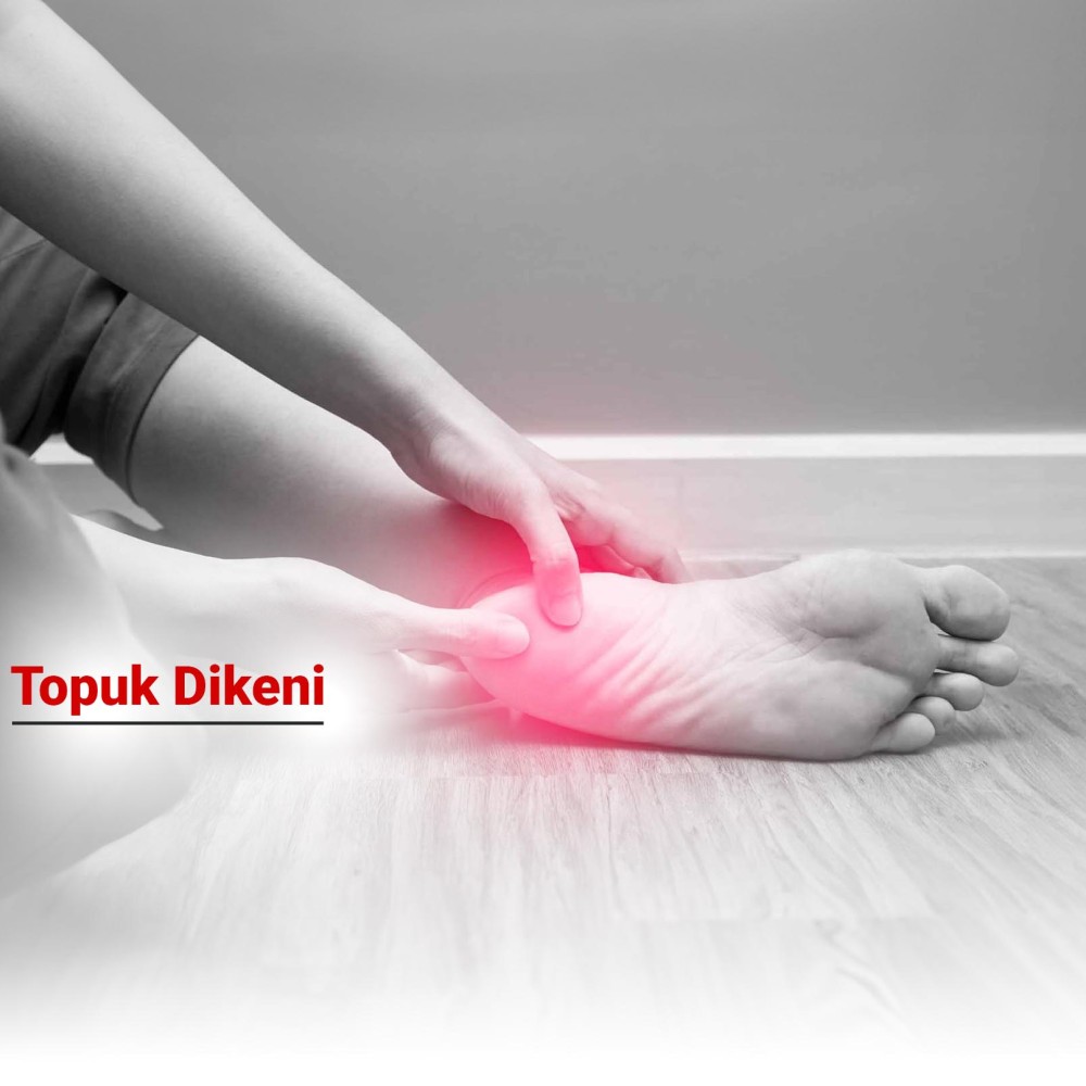 Topuk Dikeni Nedir? Belirtileri, Nedenleri ve Tedavi Yöntemleri