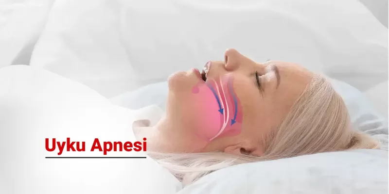 Uyku Apnesi Nedir? Neden Olur? Belirtileri ve Tedavisi