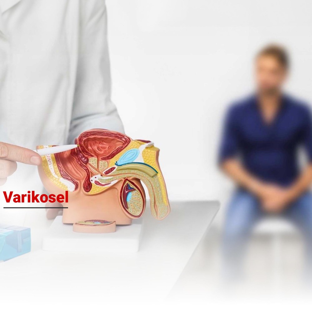 Varikosel Nedir? Belirtileri, Nedenleri ve Tedavi Yöntemleri
